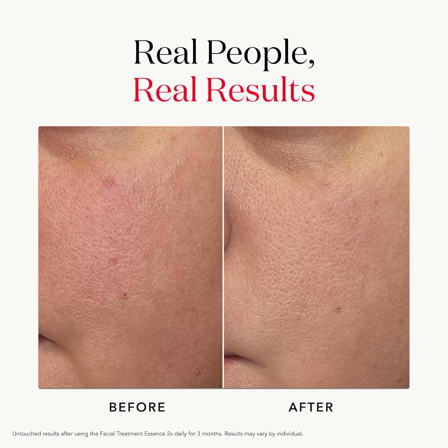 SK-II Facial Treatment Essence with Pitera – Hydrating & Anti-Aging Skin Miracle Water