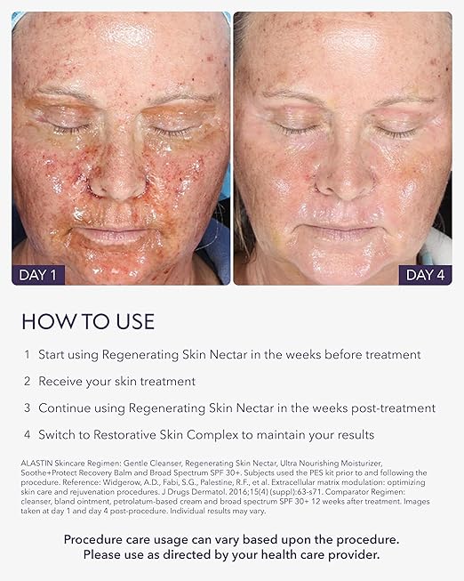ALASTIN Skincare Regenerating Skin Nectar Face Moisturizer (1 oz) | Hydrating Serum for Smoother-Looking Skin | Suitable for Sensitive Skin