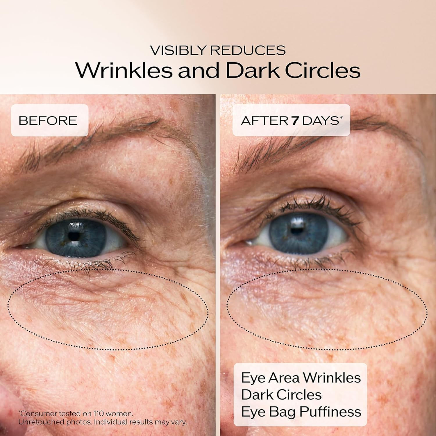 Shiseido Benefiance Wrinkle Smoothing Eye Cream – Anti-Aging & Hydrating Under Eye Treatment