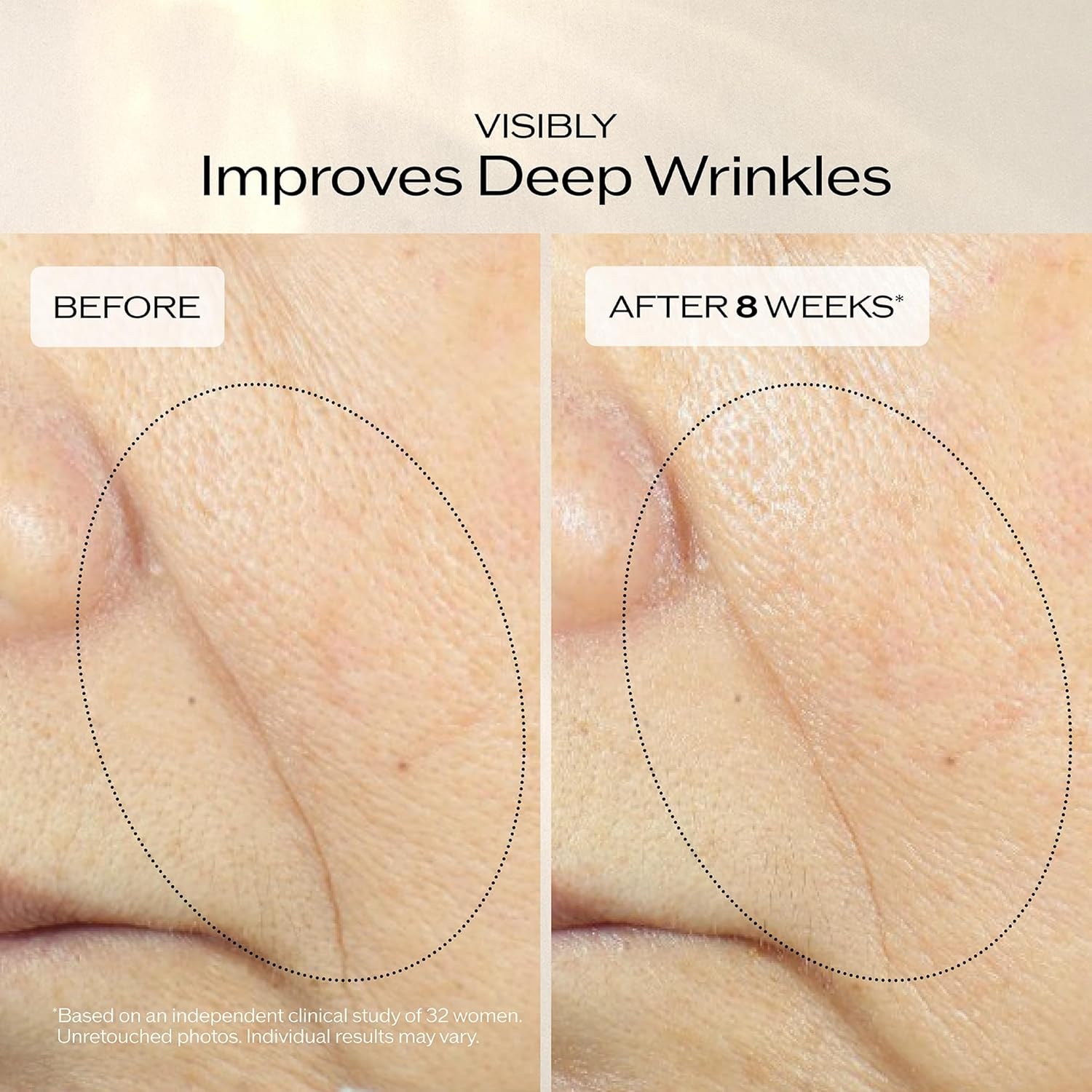 Shiseido Vital Perfection Uplifting and Firming Advanced Cream – Anti-Aging Face Moisturizer with ReNeuraRED Technology