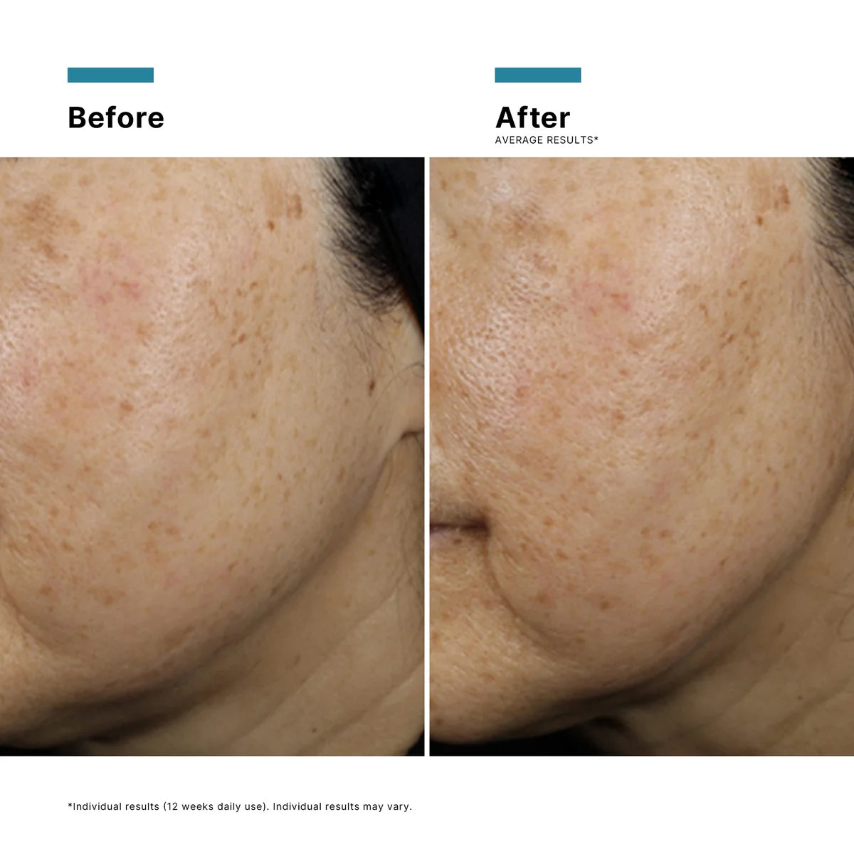 A.G.E. Interrupter Ultra Serum